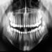 Cirurgia Bucomaxilofacial - Sá Caye Odontologia