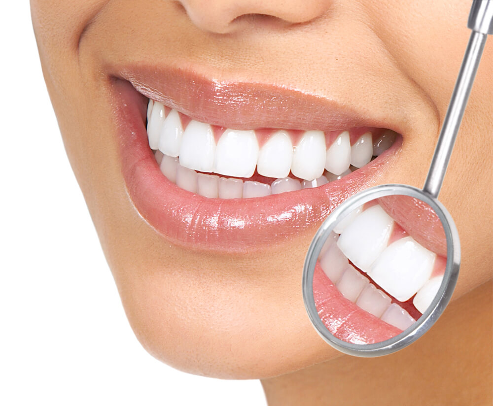 Tratamentos Preventivos - Sá Caye Odontologia